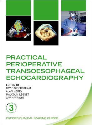 Read Practical Perioperative Transoesophageal Echocardiography - David Sidebotham | PDF