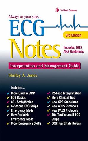 Download ECG Notes Interpretation and Management Guide - Shirley A Jones file in ePub
